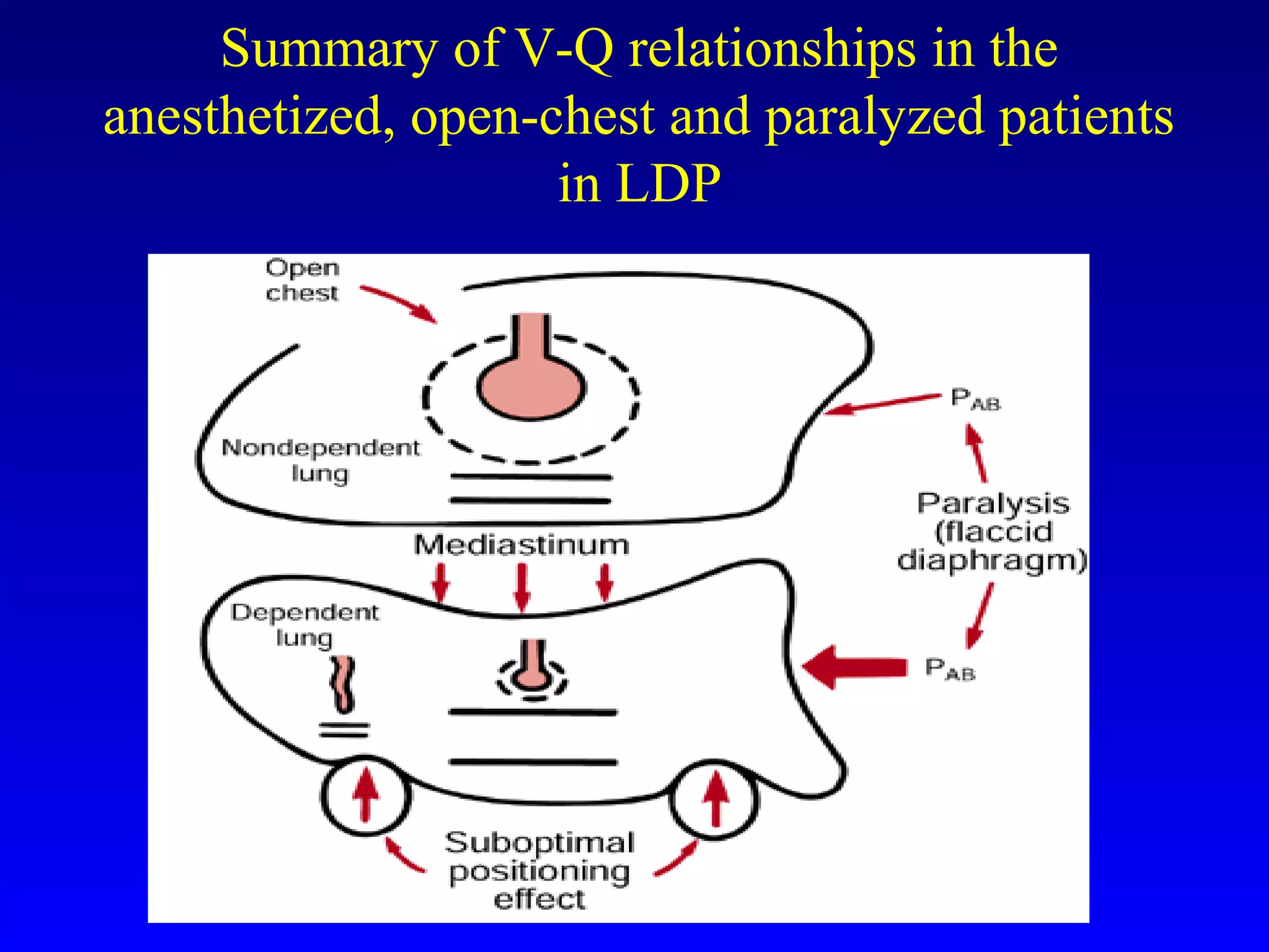 Summary of V-Q relationships in the
anesthetized, open-chest and paralyzed patients
in LDP
 