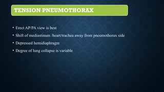 TENSION PNEUMOTHORAX
• Erect AP/PA view is best
• Shift of mediastinum /heart/trachea away from pneumothorax side
• Depressed hemidiaphragm
• Degree of lung collapse is variable
 