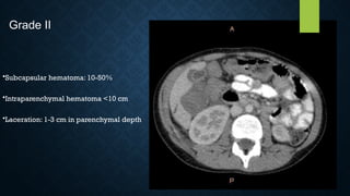 •Subcapsular hematoma: 10-50%
•Intraparenchymal hematoma <10 cm
•Laceration: 1-3 cm in parenchymal depth
Grade II
 
