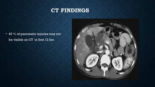 CT FINDINGS
• 40 % of pancreatic injuries may not
be visible on CT in first 12 hrs
 
