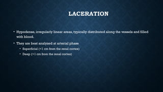 LACERATION
• Hypodense, irregularly linear areas, typically distributed along the vessels and filled
with blood.
• They are best analyzed at arterial phase
• Superficial (<1 cm from the renal cortex)
• Deep (>1 cm from the renal cortex)
 