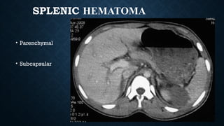 SPLENIC HEMATOMA
• Parenchymal
• Subcapsular
 
