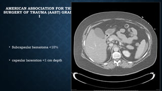 AMERICAN ASSOCIATION FOR THE
SURGERY OF TRAUMA (AAST) GRADE
I
• Subcapsular hematoma <10%
• capsular laceration <1 cm depth
 