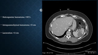 GRADE III
• Subcapsular hematoma >50%
• Intraparenchymal hematoma >5 cm
• Laceration >3 cm
 