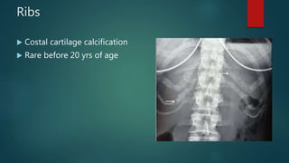 Thoracic anatomy on various imaging modalities | PPTX