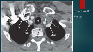 Thoracic Inlet Radiology Thoracic anatomy on various imaging modalities | PPTX