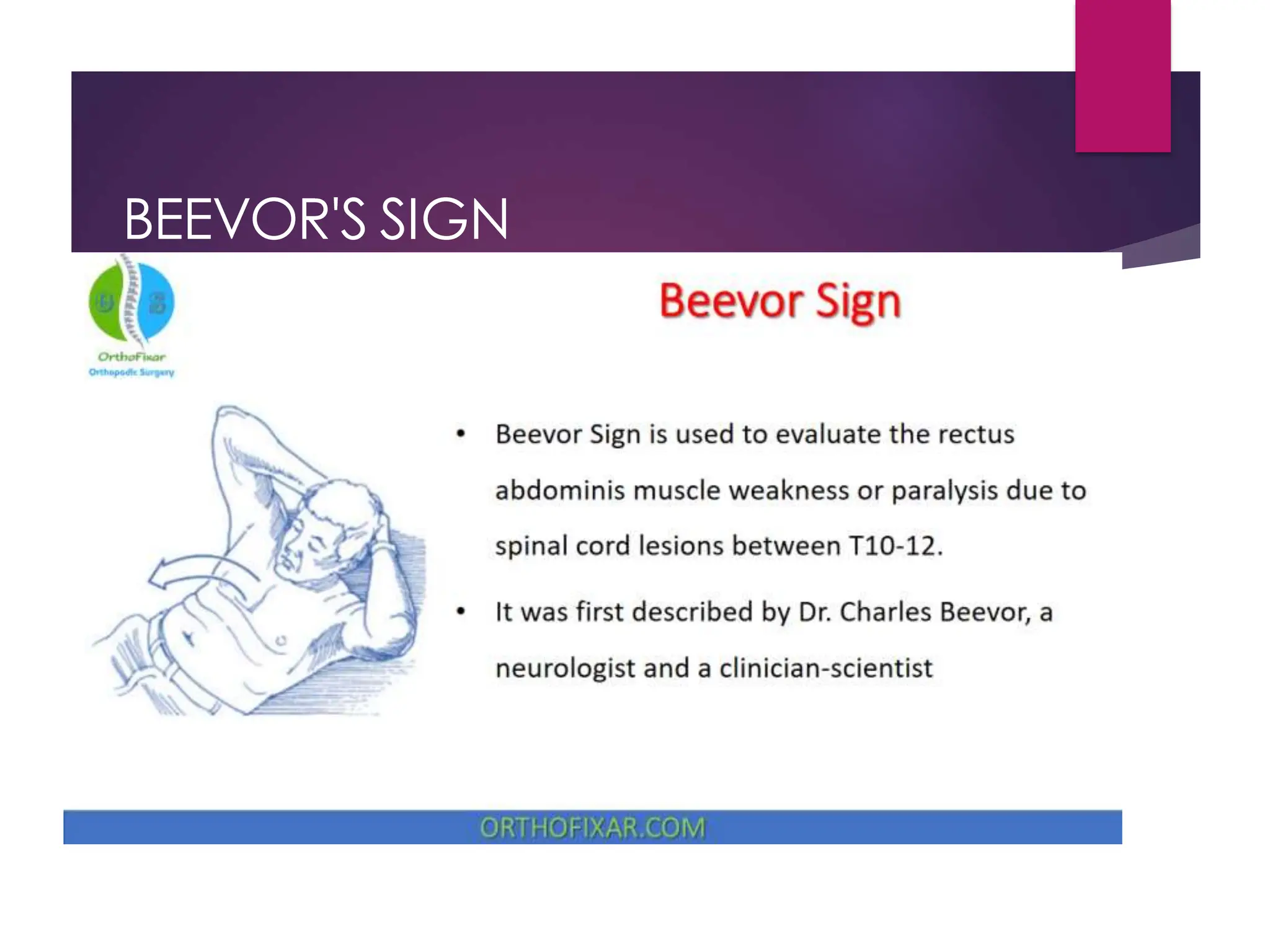 BEEVOR'S SIGN
 