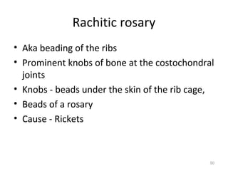 Thoracic cage | PPT