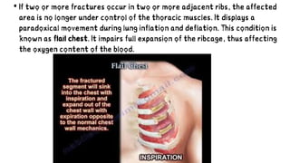 Two Adject Ribs The Thoracic Cage by Prof. A. U. Ekanem.pdf