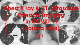 Thoracic imaging in corona virus دور الاشعة فى تشخيص فبروس كورونا