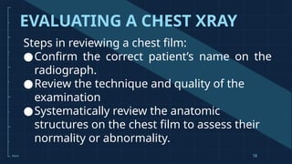 Diagnostic-Thoracic Imaging Studies .pptx
