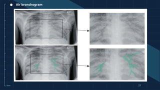 Diagnostic-Thoracic Imaging Studies .pptx