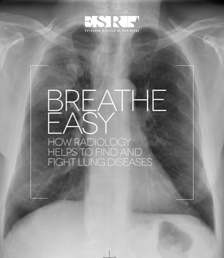 BREATHE
EASY
HOW RADIOLOGY
HELPS TO FIND AND
FIGHT LUNG DISEASES

 