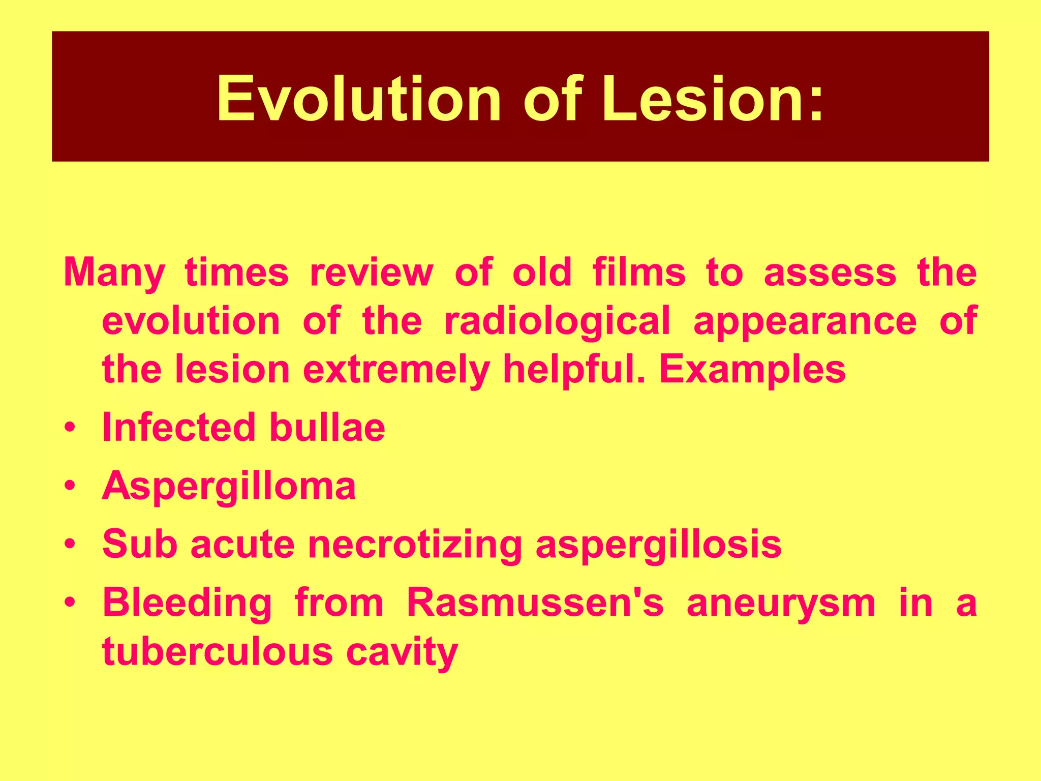 Evolution of Lesion:
Many times review of old films to assess the
evolution of the radiological appearance of
the lesion extremely helpful. Examples
• Infected bullae
• Aspergilloma
• Sub acute necrotizing aspergillosis
• Bleeding from Rasmussen's aneurysm in a
tuberculous cavity

 