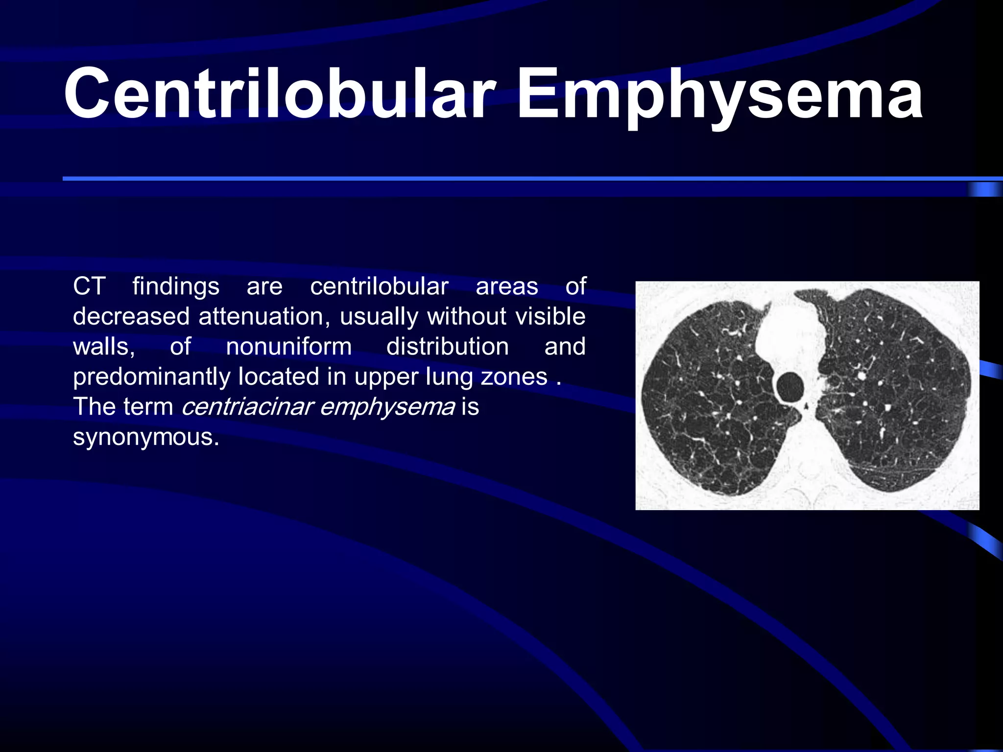 Centrilobular Emphysema
CT findings are centrilobular areas of
decreased attenuation, usually without visible
walls, of nonuniform distribution and
predominantly located in upper lung zones .
The term centriacinar emphysema is
synonymous.

 