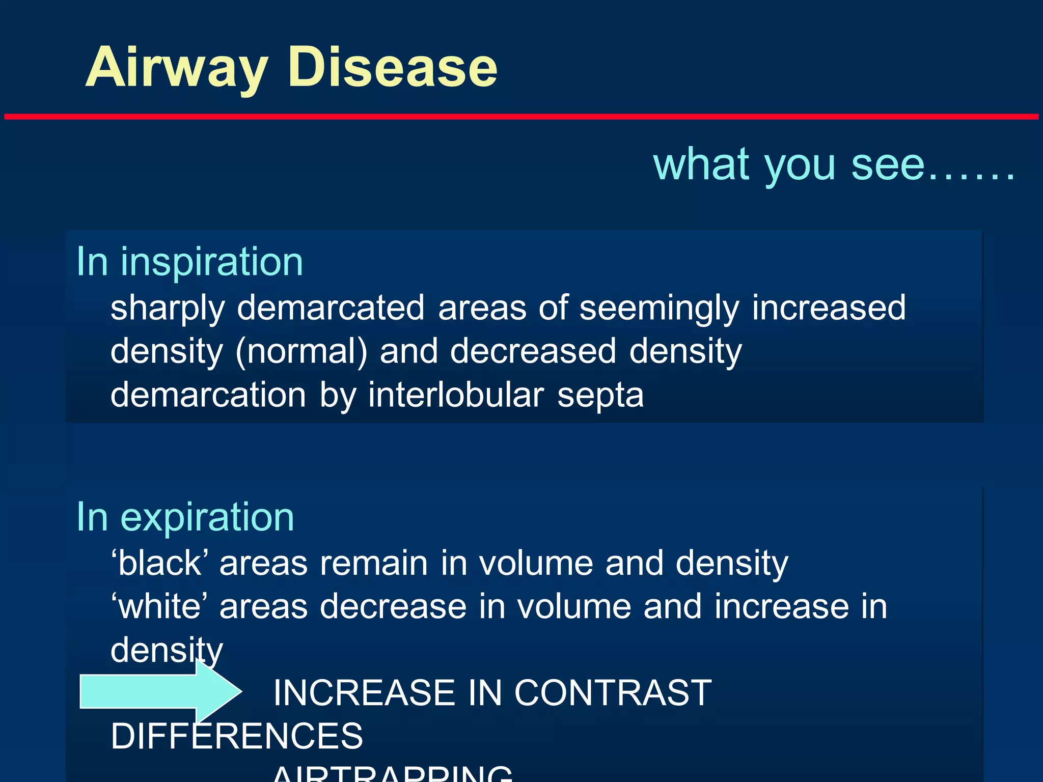 Airway Disease
what you see……
In inspiration
sharply demarcated areas of seemingly increased
density (normal) and decreased density
demarcation by interlobular septa

In expiration
‘black’ areas remain in volume and density
‘white’ areas decrease in volume and increase in
density
INCREASE IN CONTRAST
DIFFERENCES

 
