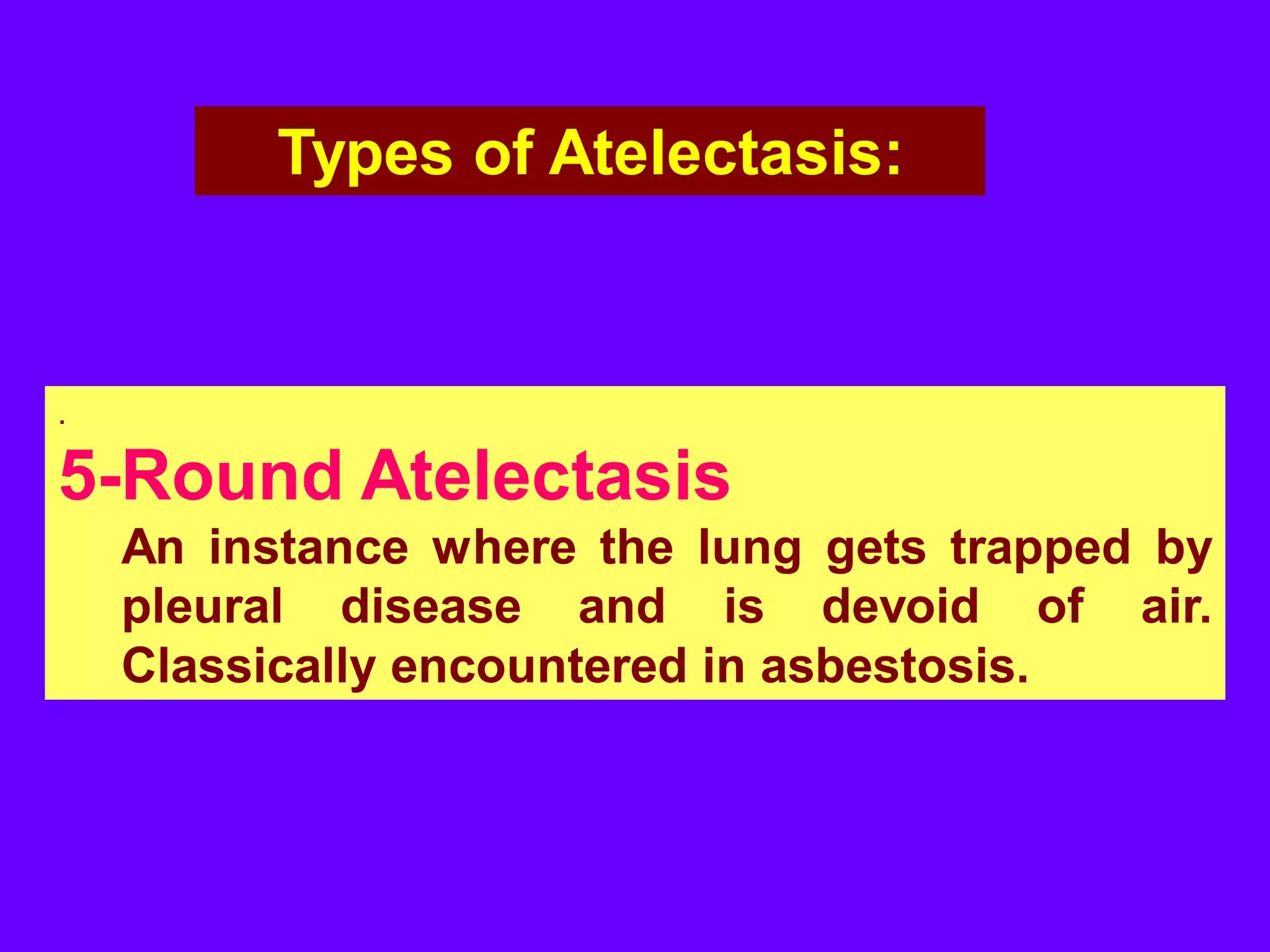 Types of Atelectasis:

.

5-Round Atelectasis
An instance where the lung gets trapped by
pleural disease and is devoid of air.
Classically encountered in asbestosis.

 