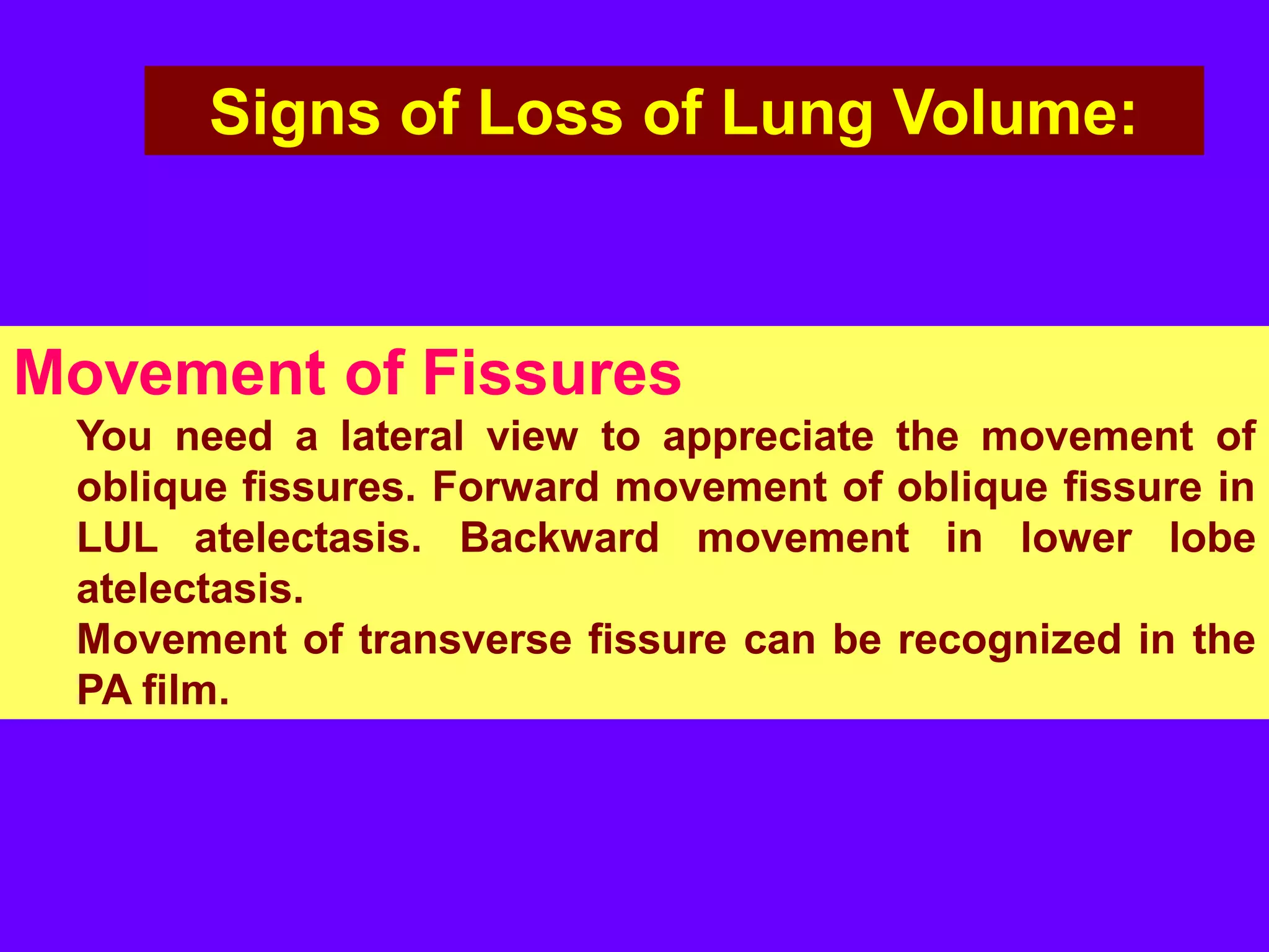 Signs of Loss of Lung Volume:

Movement of Fissures
You need a lateral view to appreciate the movement of
oblique fissures. Forward movement of oblique fissure in
LUL atelectasis. Backward movement in lower lobe
atelectasis.
Movement of transverse fissure can be recognized in the
PA film.

 