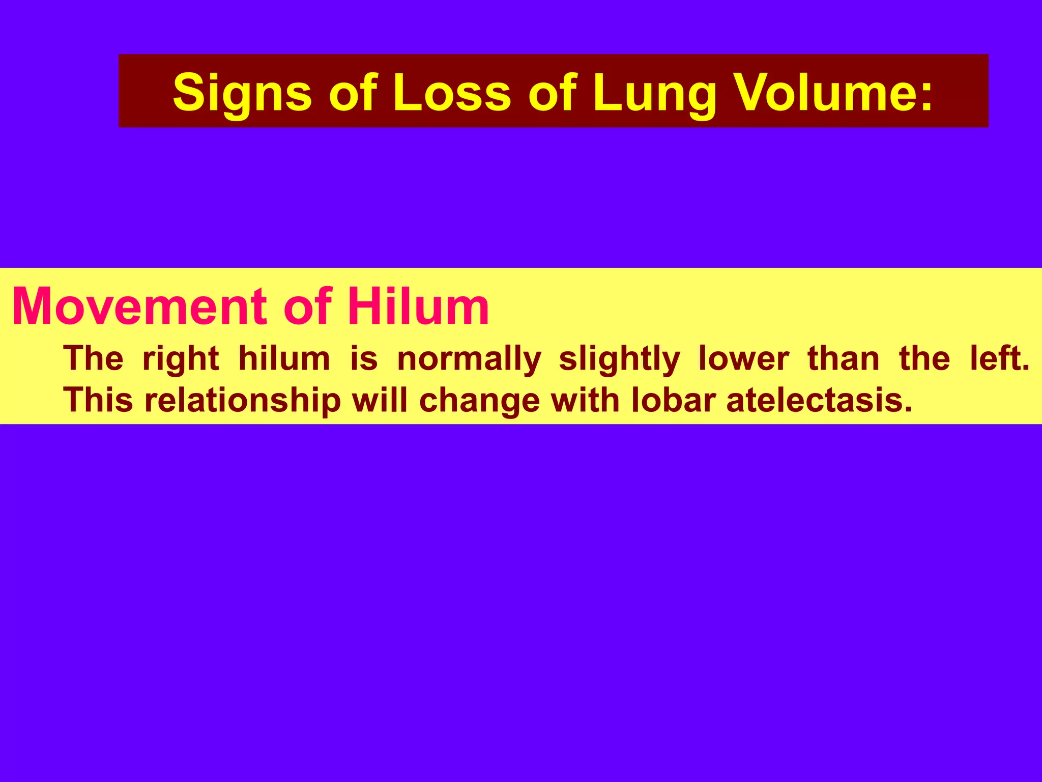 Signs of Loss of Lung Volume:

Movement of Hilum
The right hilum is normally slightly lower than the left.
This relationship will change with lobar atelectasis.

 