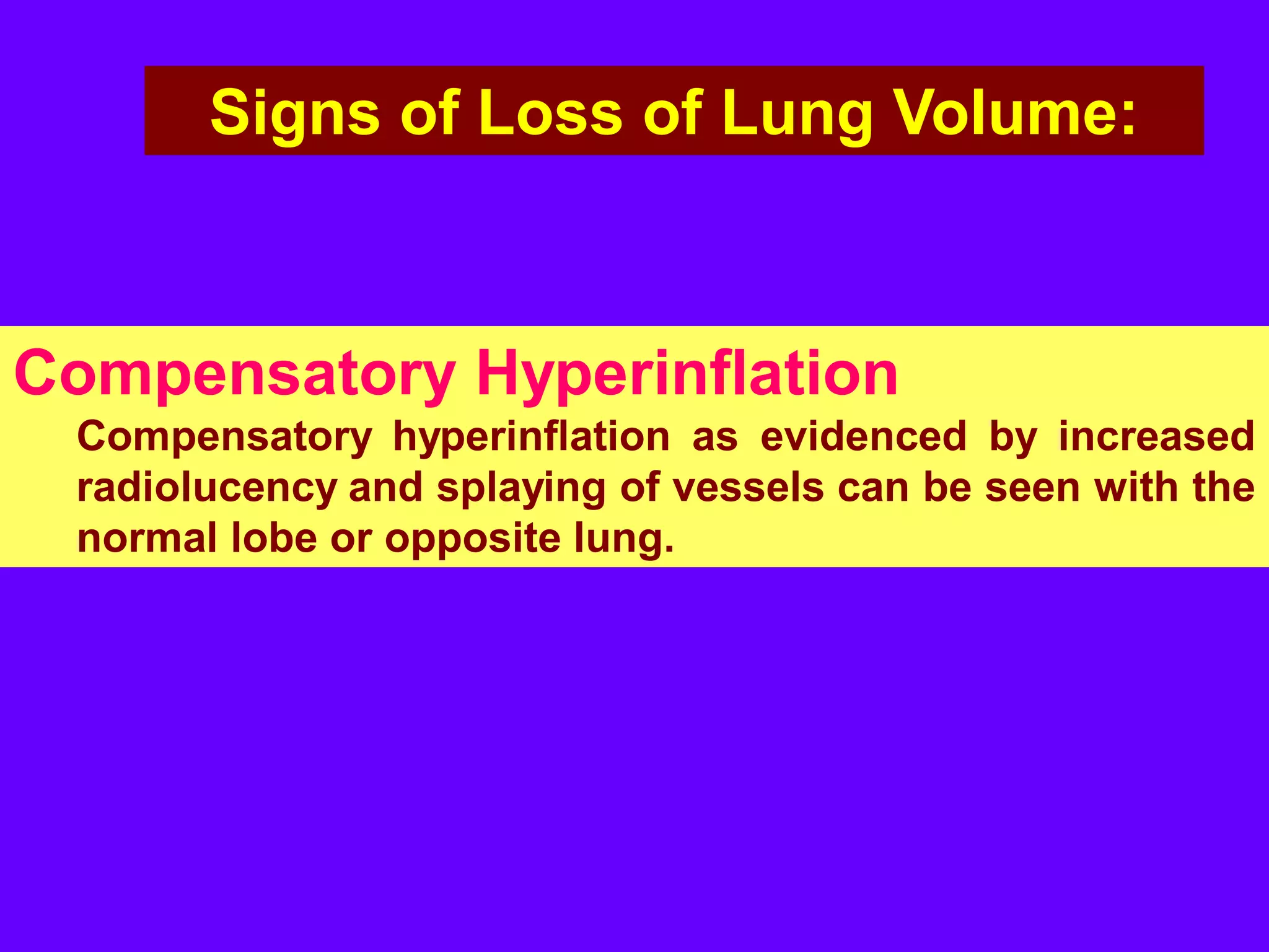 Signs of Loss of Lung Volume:

Compensatory Hyperinflation
Compensatory hyperinflation as evidenced by increased
radiolucency and splaying of vessels can be seen with the
normal lobe or opposite lung.

 