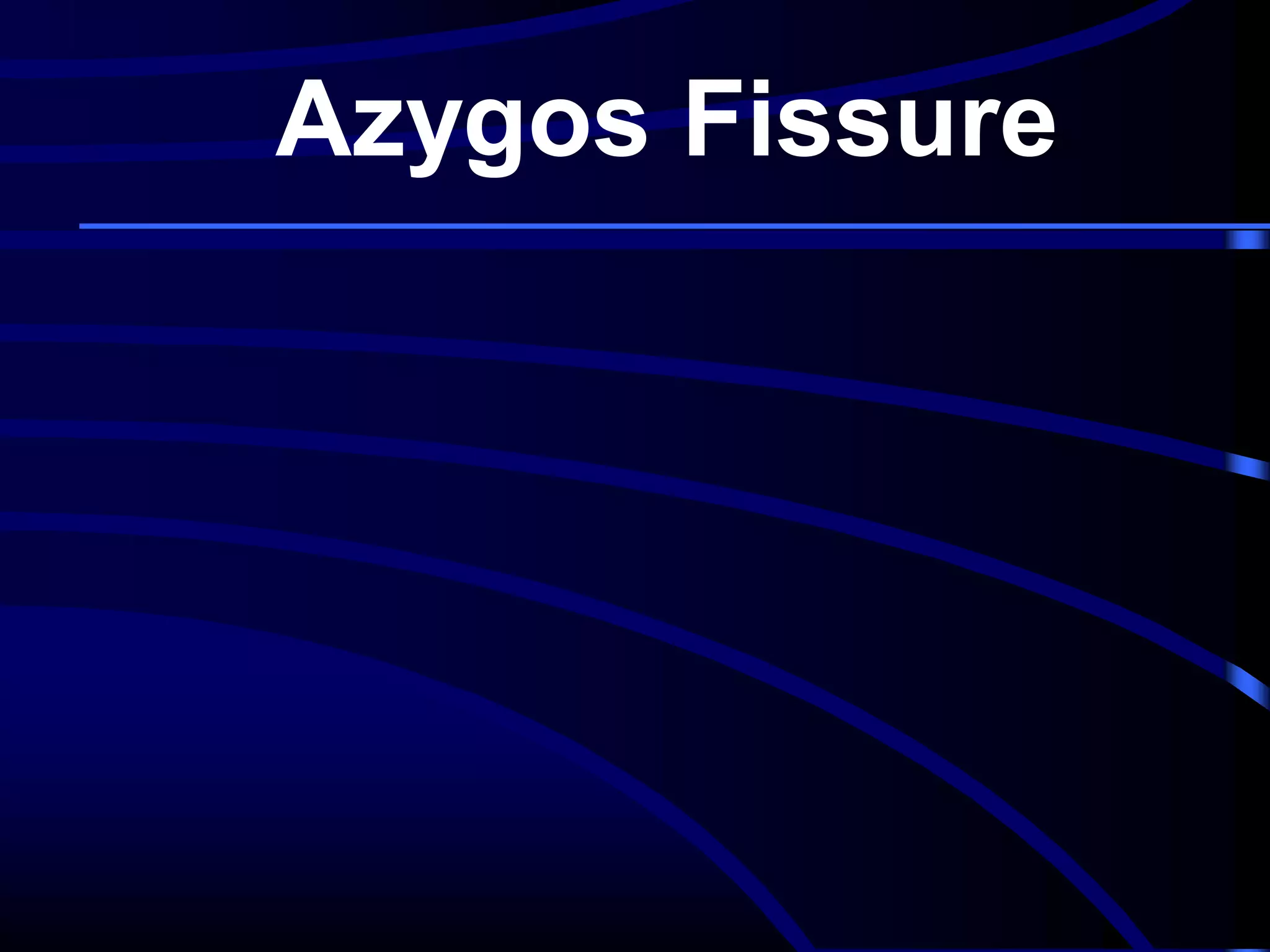 Azygos Fissure

 