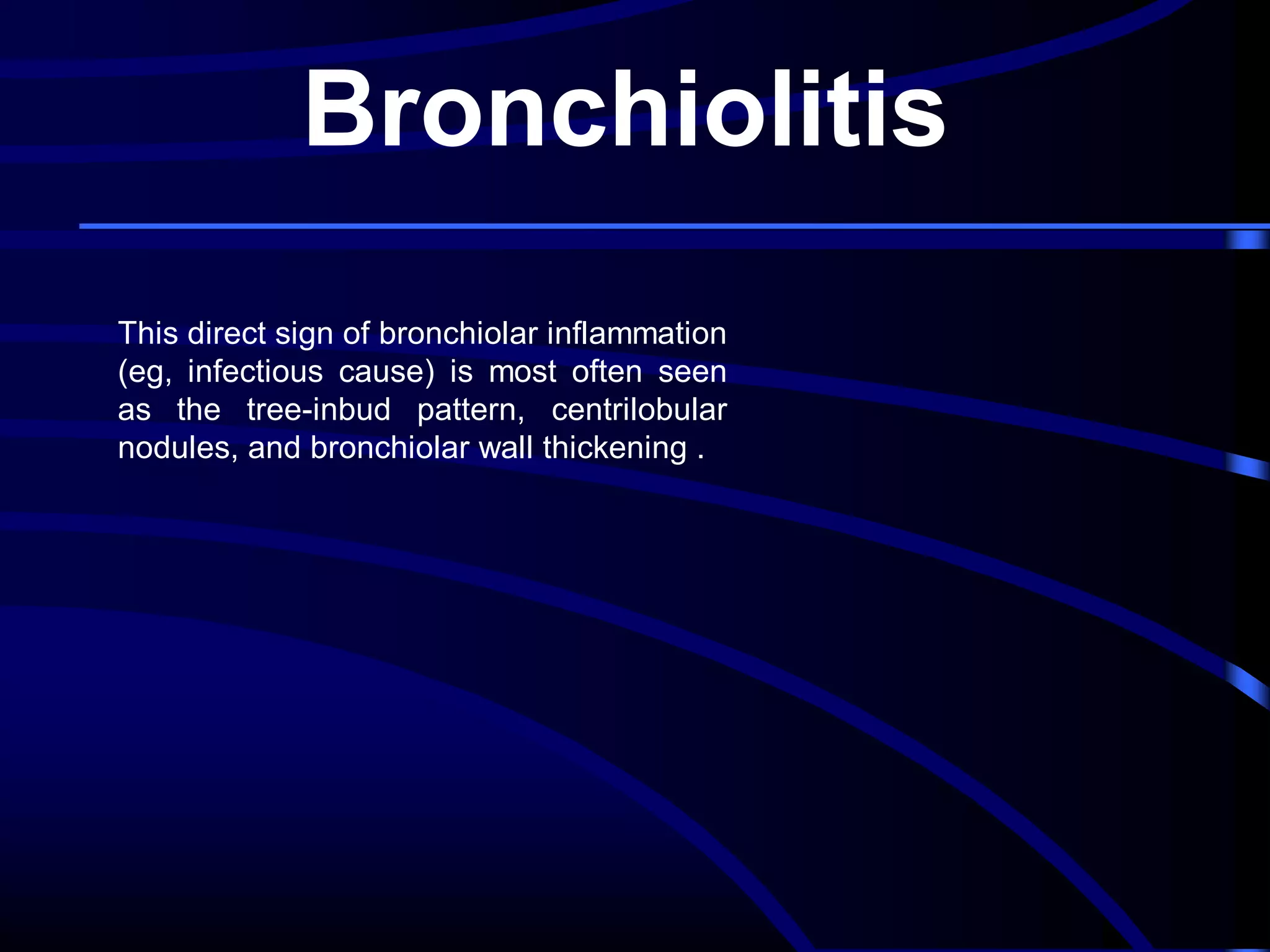 Bronchiolitis
This direct sign of bronchiolar inflammation
(eg, infectious cause) is most often seen
as the tree-inbud pattern, centrilobular
nodules, and bronchiolar wall thickening .

 