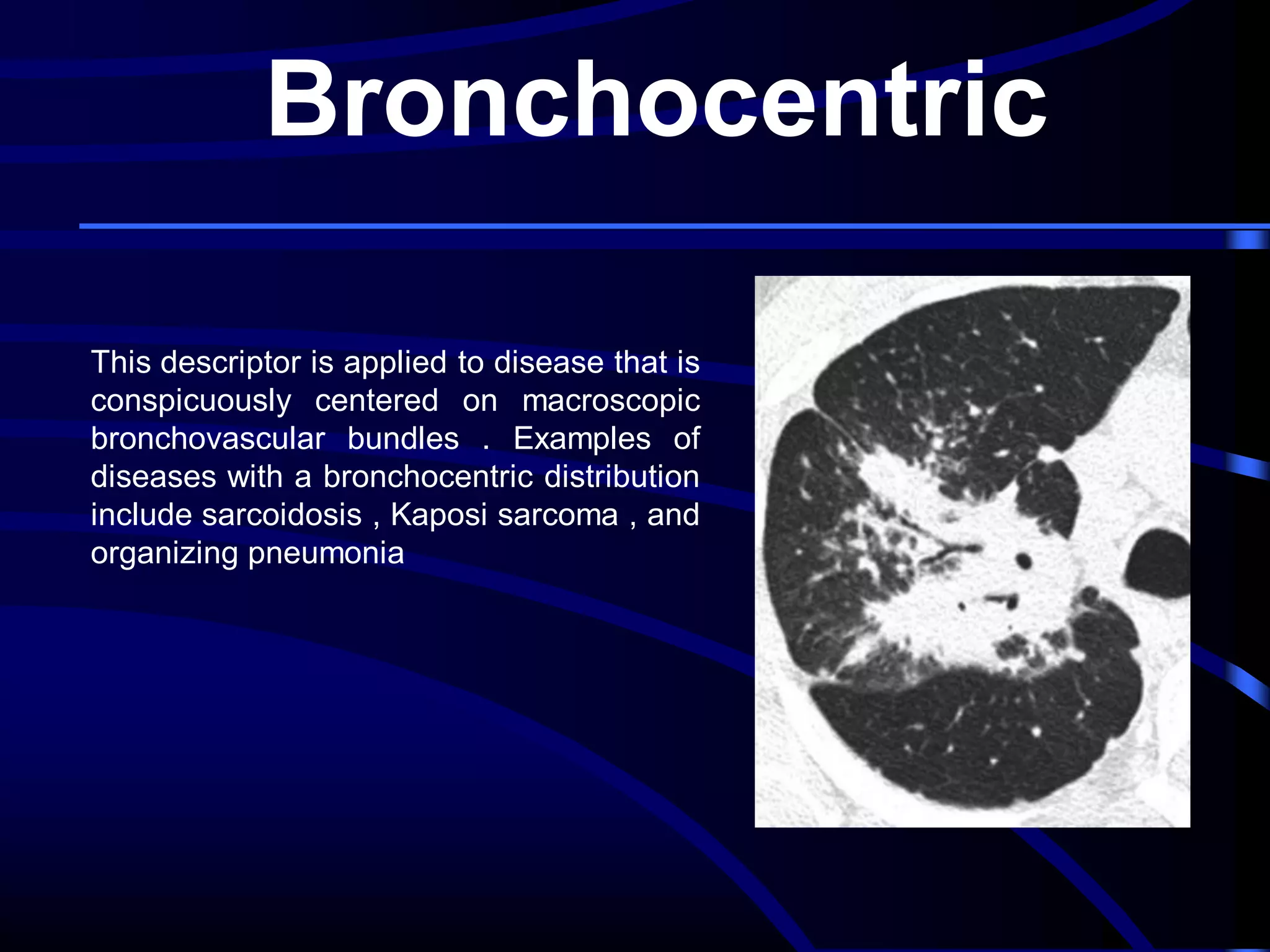 Bronchocentric
This descriptor is applied to disease that is
conspicuously centered on macroscopic
bronchovascular bundles . Examples of
diseases with a bronchocentric distribution
include sarcoidosis , Kaposi sarcoma , and
organizing pneumonia

 