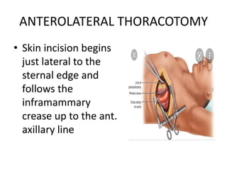 THORACIC INCISIONS a powerpoint for general surgeons | PPTX