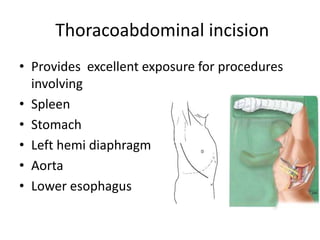 THORACIC INCISIONS a powerpoint for general surgeons | PPTX