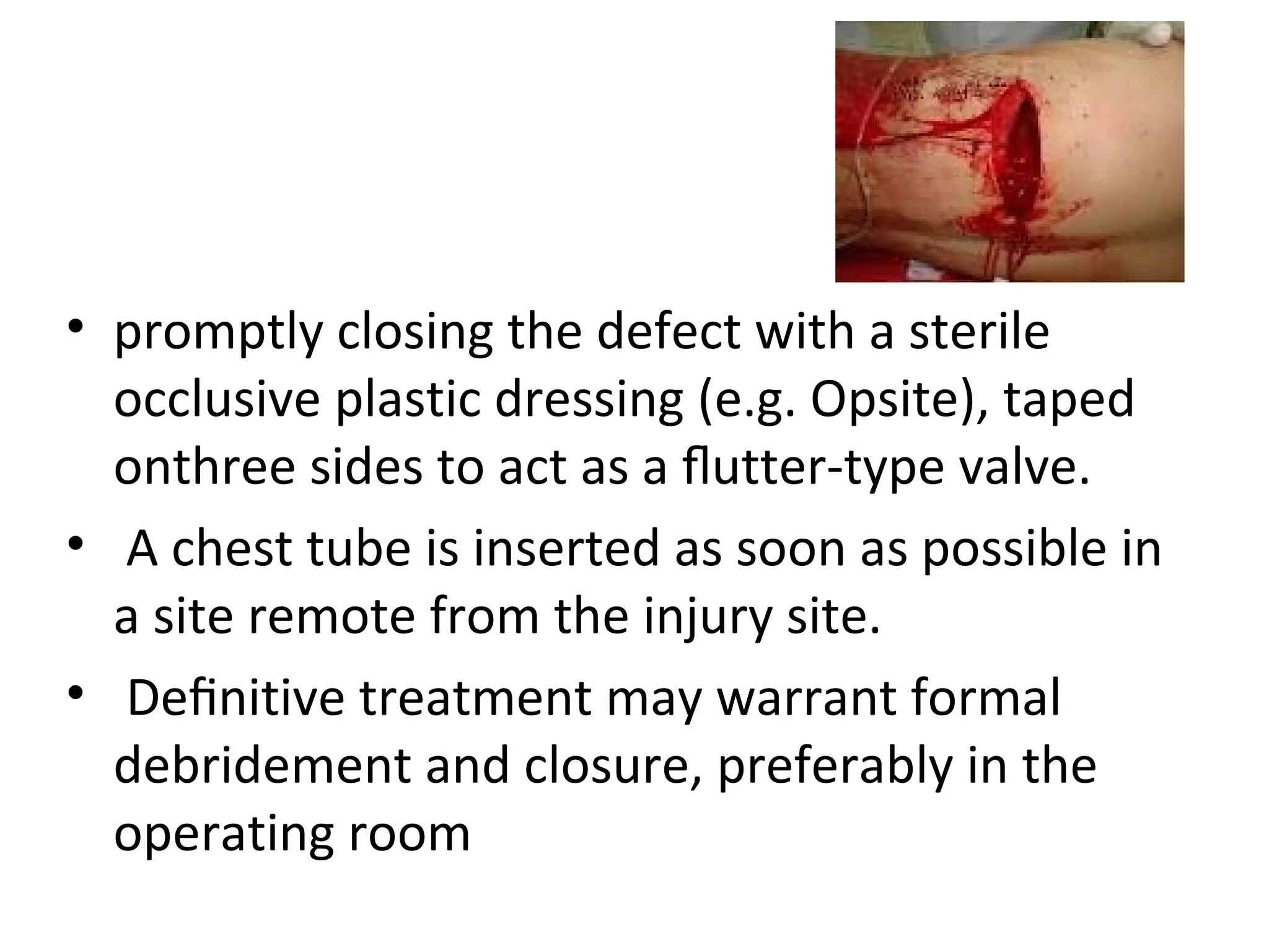 • promptly closing the defect with a sterile
occlusive plastic dressing (e.g. Opsite), taped
onthree sides to act as a ﬂutter-type valve.
• A chest tube is inserted as soon as possible in
a site remote from the injury site.
• Deﬁnitive treatment may warrant formal
debridement and closure, preferably in the
operating room

 
