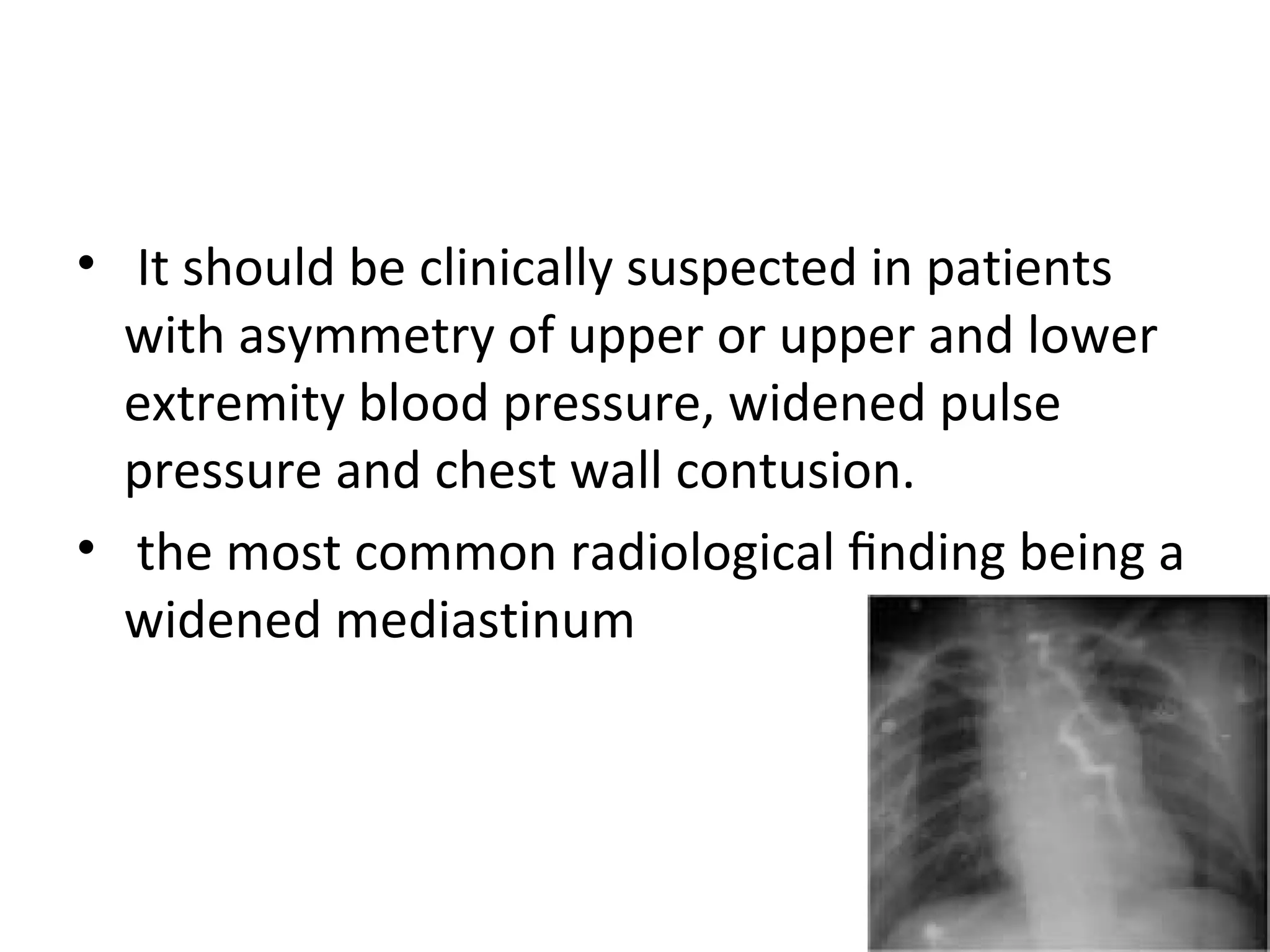 • It should be clinically suspected in patients
with asymmetry of upper or upper and lower
extremity blood pressure, widened pulse
pressure and chest wall contusion.
• the most common radiological ﬁnding being a
widened mediastinum

 