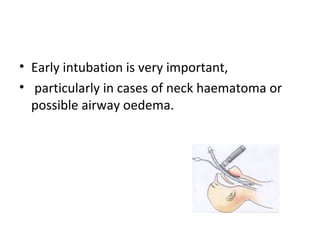 • Early intubation is very important,
• particularly in cases of neck haematoma or
possible airway oedema.

 