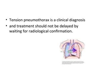 • Tension pneumothorax is a clinical diagnosis
• and treatment should not be delayed by
waiting for radiological conﬁrmation.

 