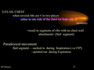 3).FLAIL CHEST
when several ribs are # in two places
either in one side of the chest (or both side of
sternum)
=result in segments of ribs with no chest wall
attachments (flail segment)
Paradoxical movement
flail segment —sucked in during Inspiration (-ve ITP)
--pushed out during Expiration
Dr Trusew 17
 
