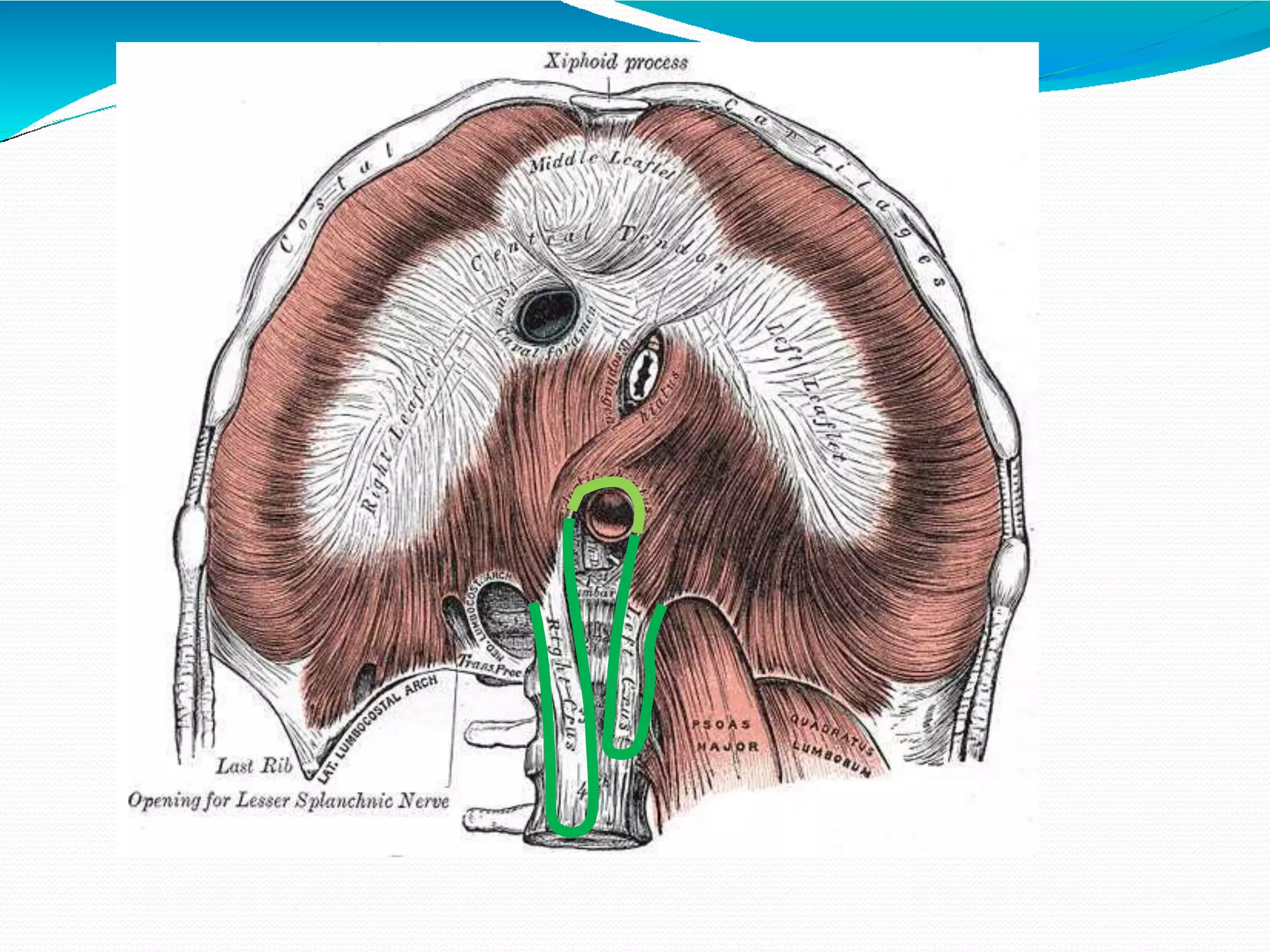 Thoracic Inlet Reflux Thoracic inlet & outlet | PPTX
