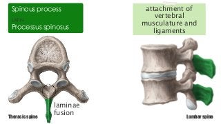 LATIN
Processus spinosus
Spinous process
laminae
fusionThoracic spine Lumbar spine
attachment of
vertebral
musculature and
ligaments
 