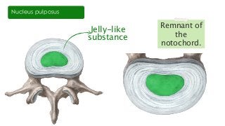 Nucleus pulposus
Jelly-like
substance
Remnant of
the
notochord.
 