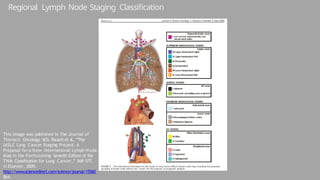 Thoracic Oncology Imaging Dr. Bosibori.pptx