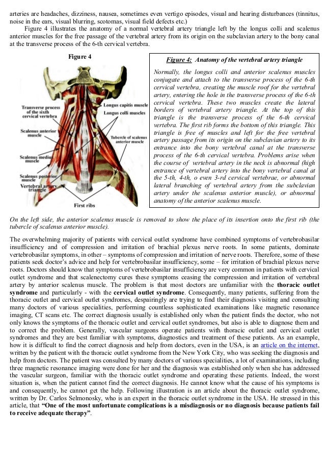 Thoracic Outlet Syndrome: Anatomy, Symptoms, Diagnostic Thoracic Outlet Syndrome: Anatomy, Symptoms, Diagnostic