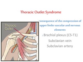 ThoracicOutlet Syndrome
consequence of the compression of
upper limbs vascular and nervous
elements
: Brachial plexus (C5-T1)
Subclavian vein
Subclavian artery
 
