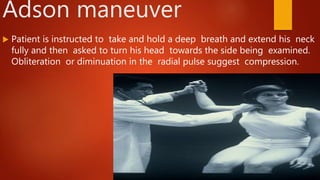Thoracic outlet syndrome | PPTX