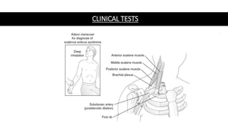 Tos Decompression Test Thoracic outlet syndrome | PPTX