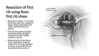 Thoracic outlet syndrome | PPTX