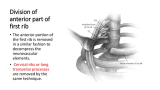 Thoracic outlet syndrome | PPTX