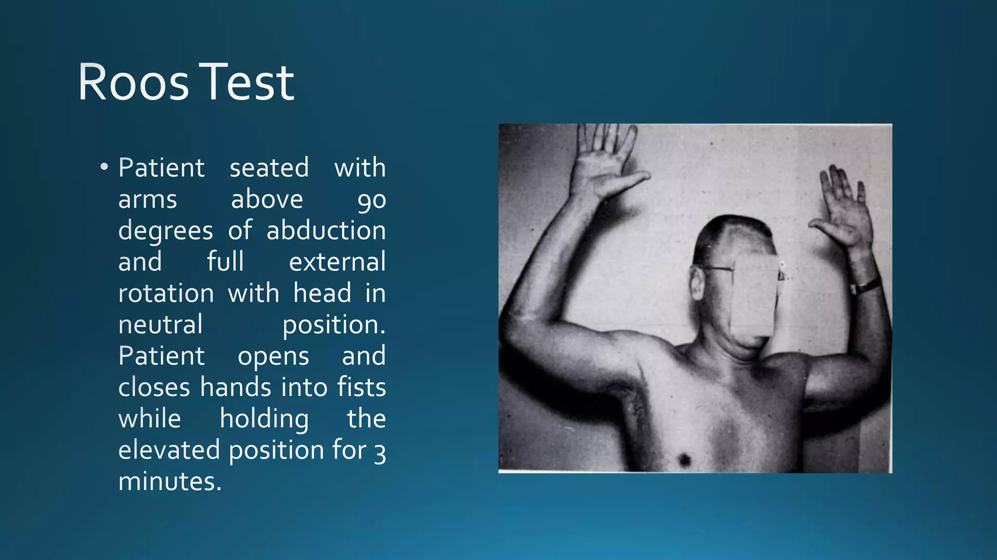 Roos Testing Thoracic outlet syndrome | PPT