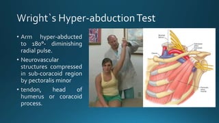 Thoracic outlet syndrome | PPTX
