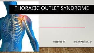 THORACIC OUTLET SYNDROME
PRESENTED BY: DR. ZUNAIRA AHMAD
 
