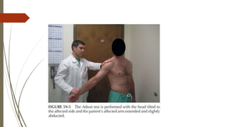 Thoracic outlet syndrome | PPTX
