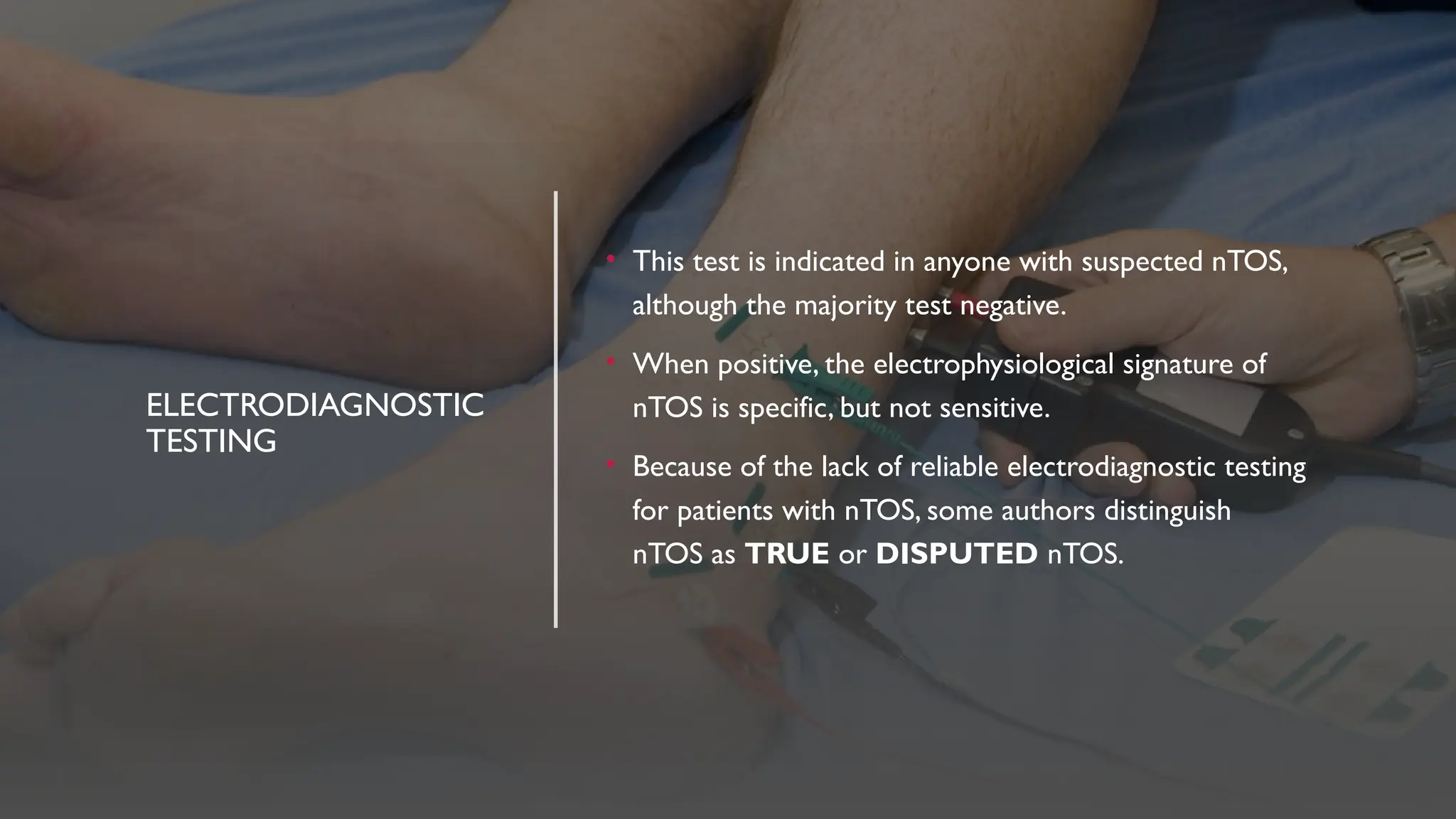 ELECTRODIAGNOSTIC
TESTING
• This test is indicated in anyone with suspected nTOS,
although the majority test negative.
• When positive, the electrophysiological signature of
nTOS is specific, but not sensitive.
• Because of the lack of reliable electrodiagnostic testing
for patients with nTOS, some authors distinguish
nTOS as TRUE or DISPUTED nTOS.
 