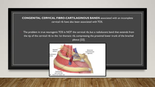 Thoracic Outlet Syndrome Review and Guidelines | PPTX